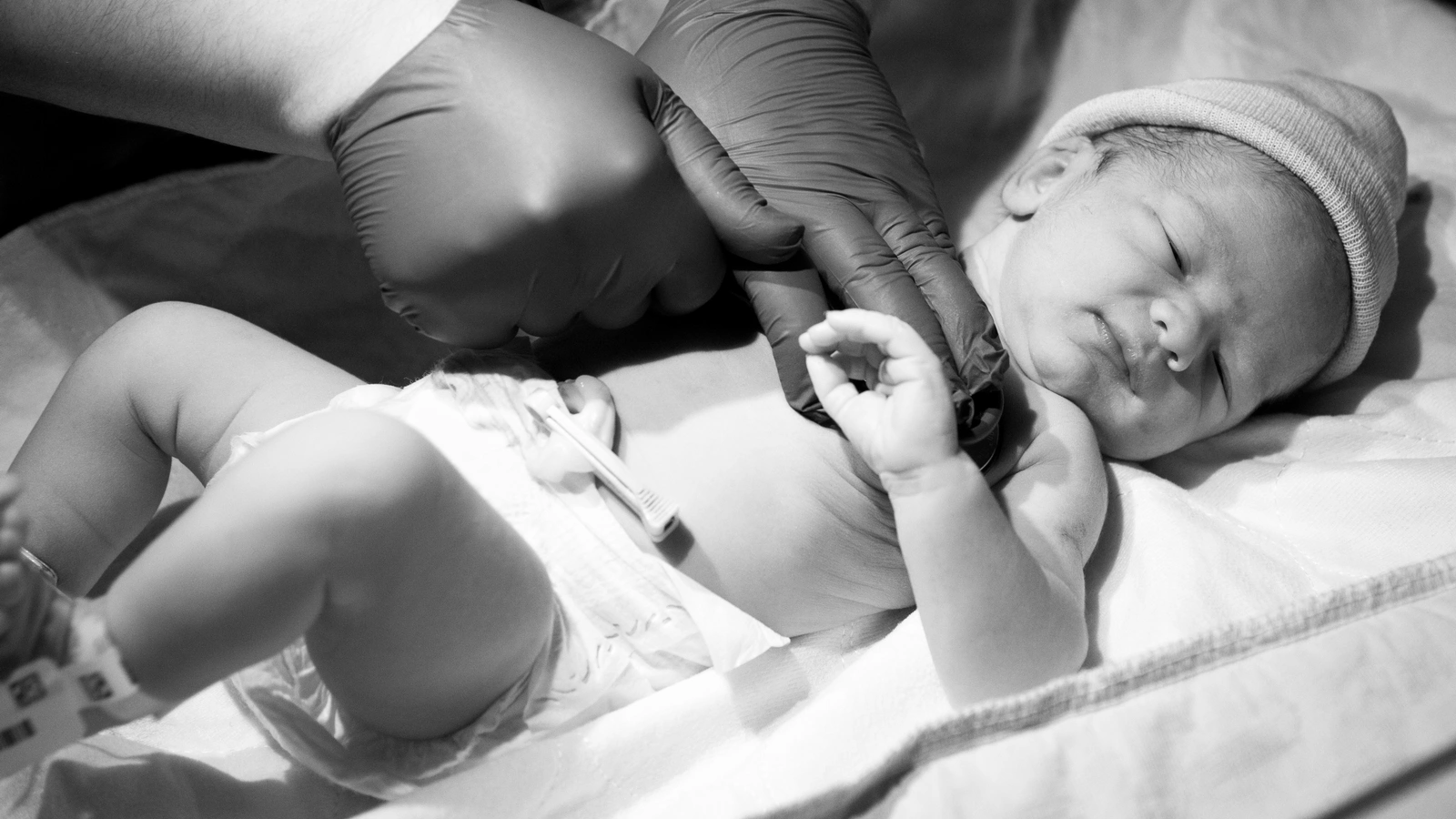 6 Cara Merawat Tali Pusar Bayi Baru Lahir