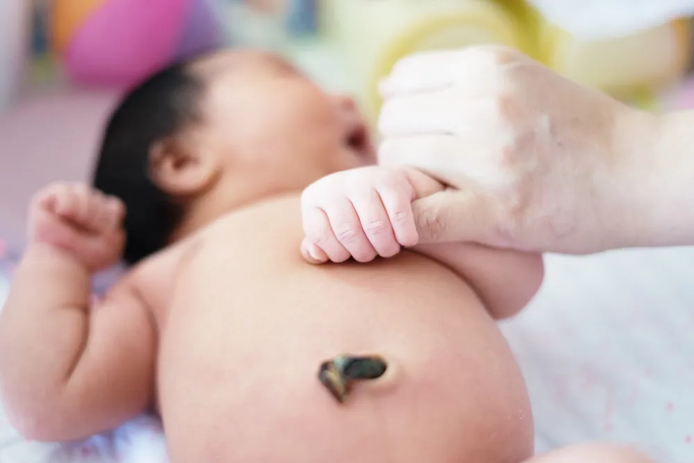 Jangan Panik! Ketahui Penyebab Pusar Bayi Berdarah dan Cara Mengatasinya